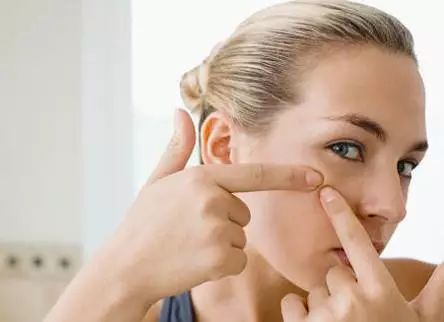 祛痘誤區(qū)以及祛痘方法