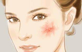 角質層變薄還能恢復嗎？角質層變薄怎么恢復？